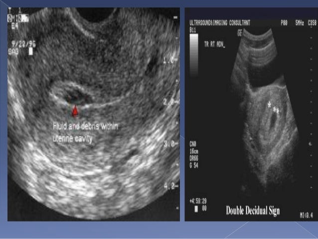 Basic Obstetric Ultrasound