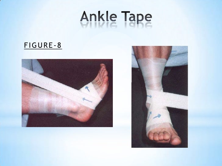 Basic principles of taping techniques Mr. Marc Lievens