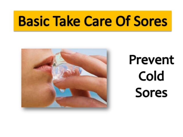 Basic tips of How to prevent cold sores