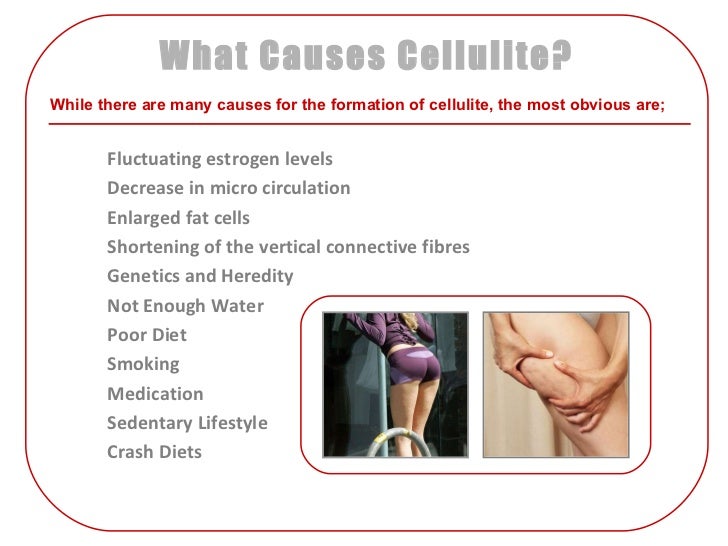 Cupping For Cellulite Treatment Pictures to Pin on ...