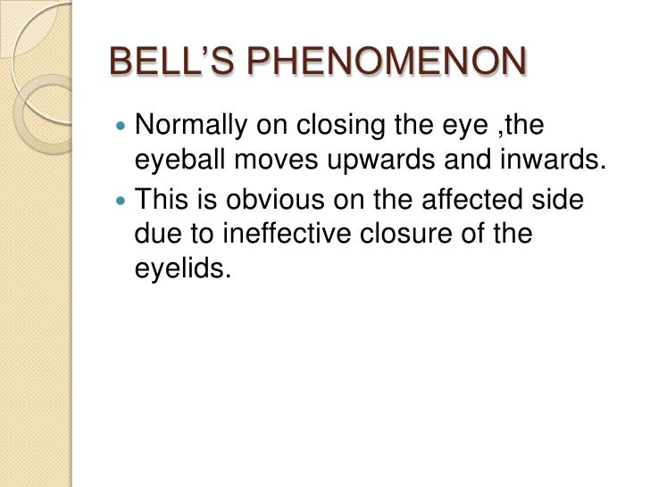 Bell’s palsy