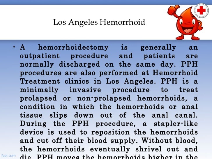 Benefits of hemorrhoid surgery