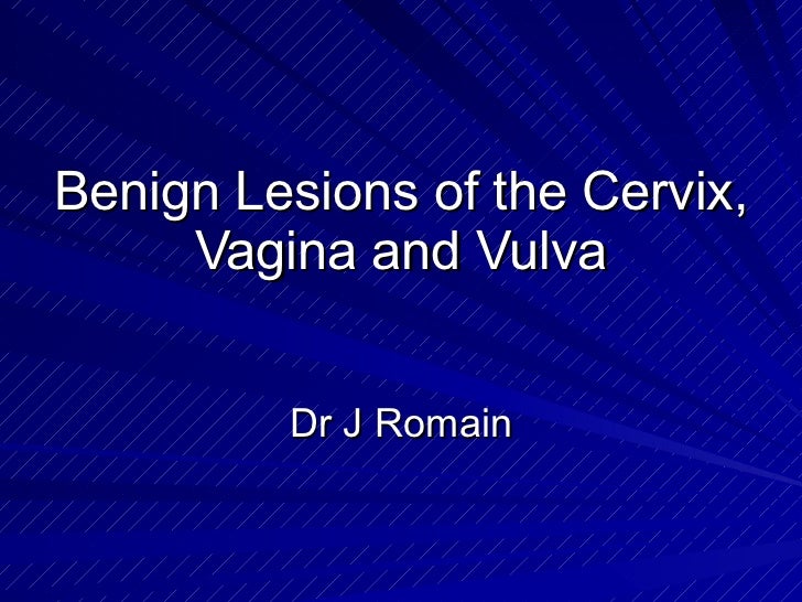 lesion on vagina