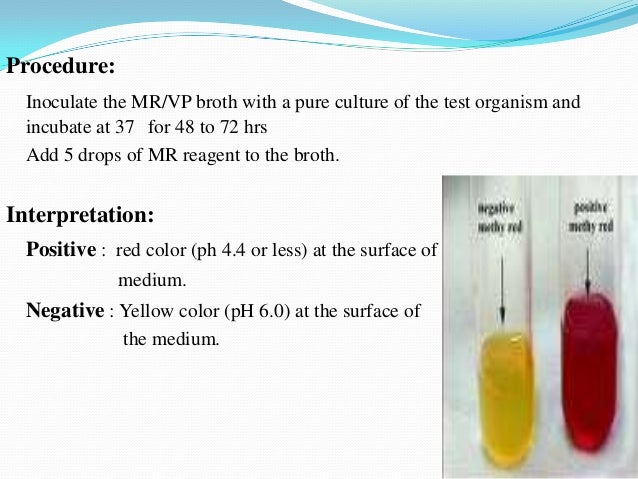 Anaerobic Gram-Negative Bacilli - Medical Microbiology ...