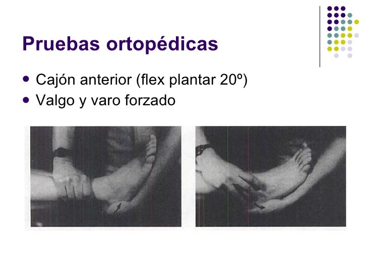 Biomecanica tobillo, pruebas funcionales y ortopedicas