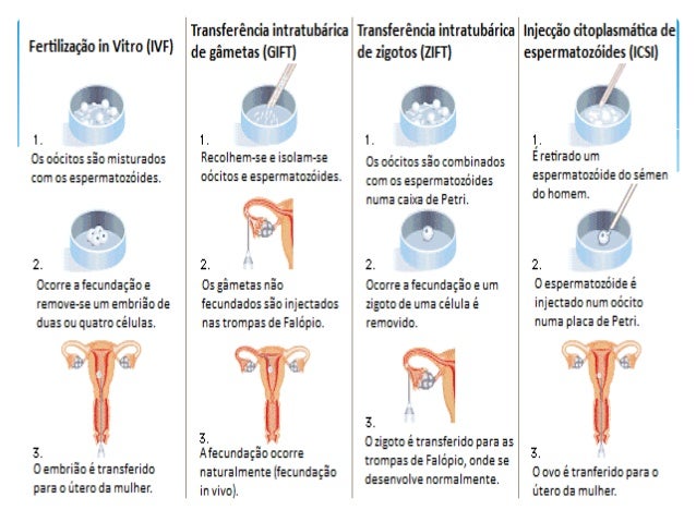 Reprodução assistida