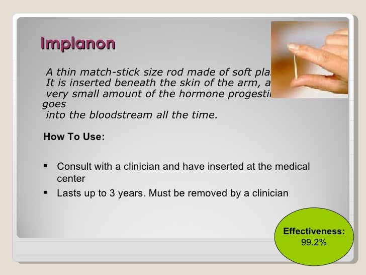 Best birth control options for smokers