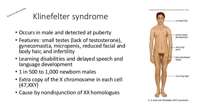 Nondisjunction of sex chromosomes in males