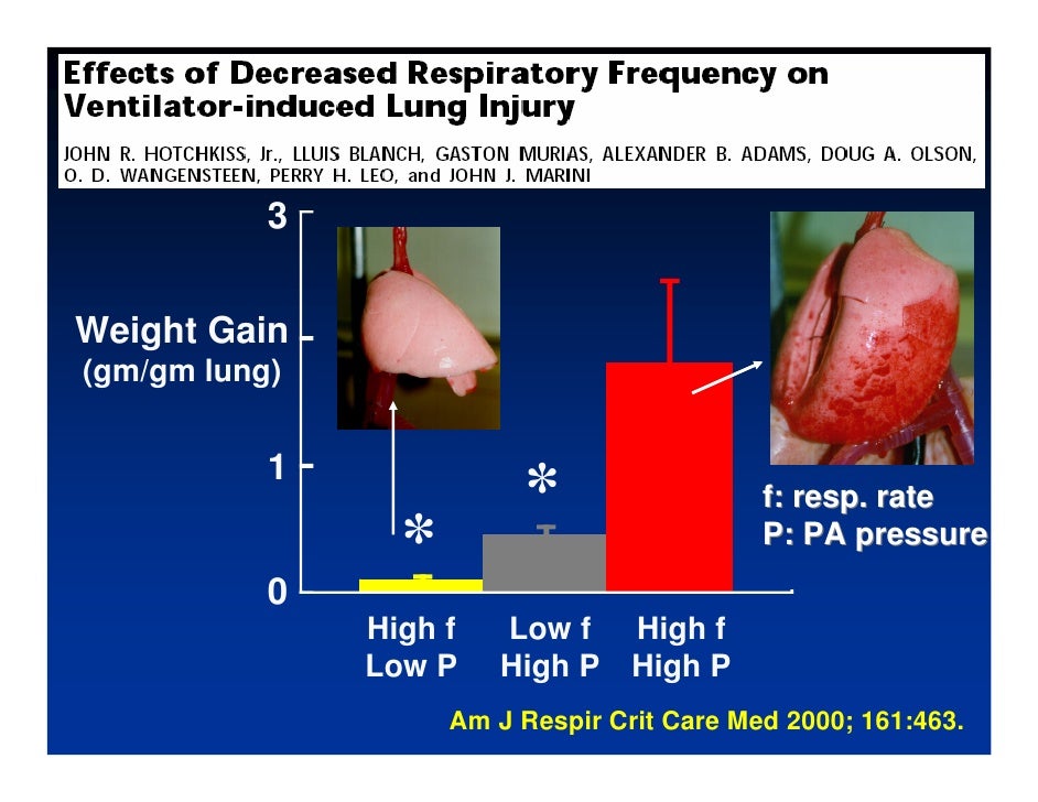 Ventilator Induced Lung Injury