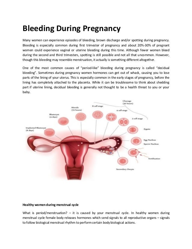 Bleeding During Pregnancy Bleeding During Pregnancy