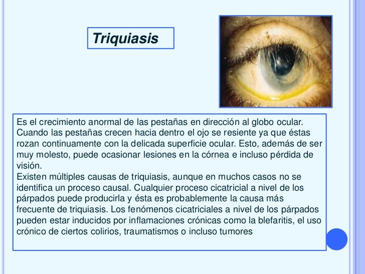 El aceite para el ajuste del óvalo de la cara