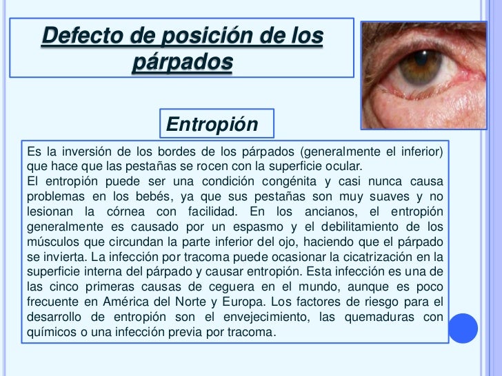 Arreglar los sacos por los ojos de los hombres