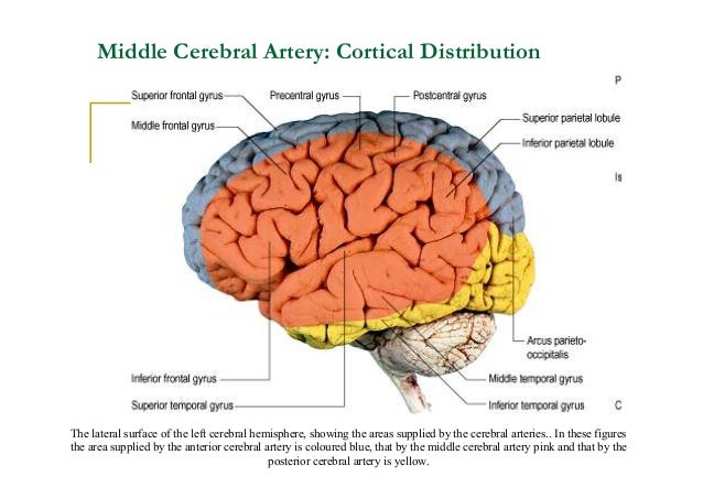 mild stroke due to excessive blood strain