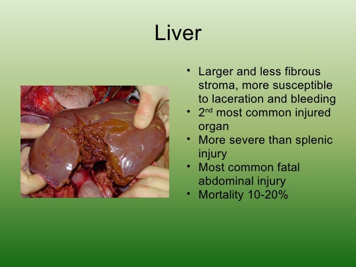 Blunt injury abdomen dissertation