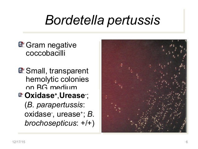 Bordetella PERTUSIS  WHOOPING COUGH  THEORY MICROBIOLOGY