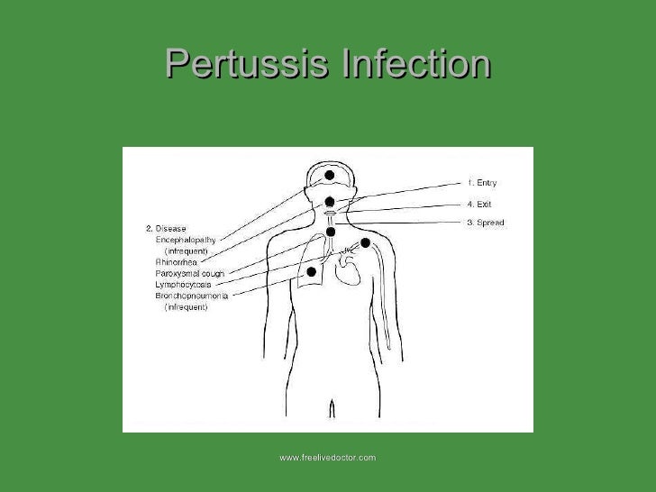 Bordetella Pertussis diagram bordetella pertussis 