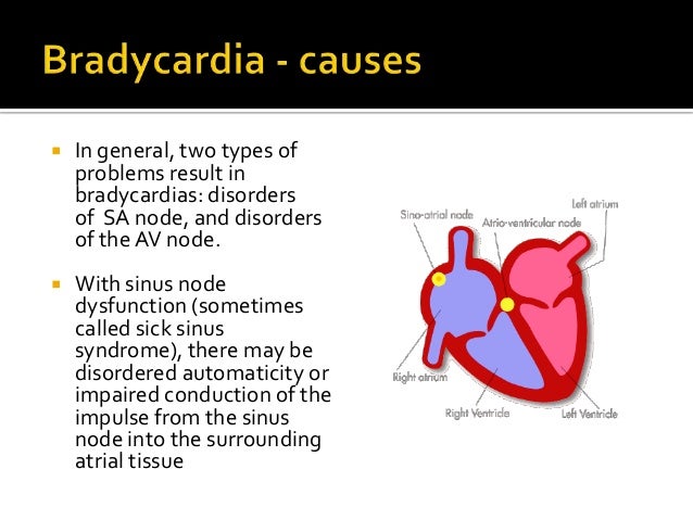 Bradycardia pals-bradycardia-algorithm-acls-medical-training