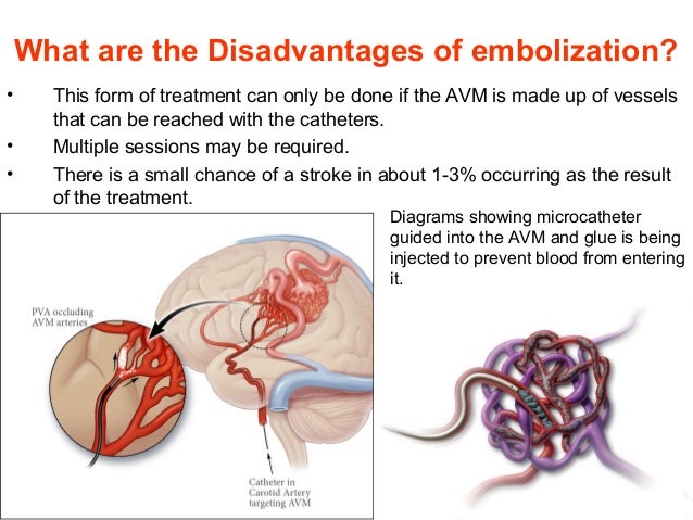 stroke recuperation years later
