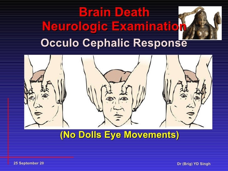 Brain death Present status YDS