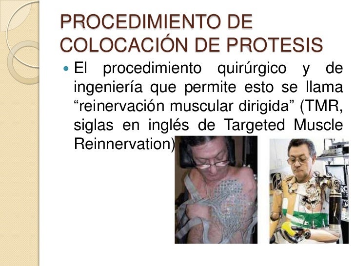 El punto en el cuerpo para el aumento del pecho