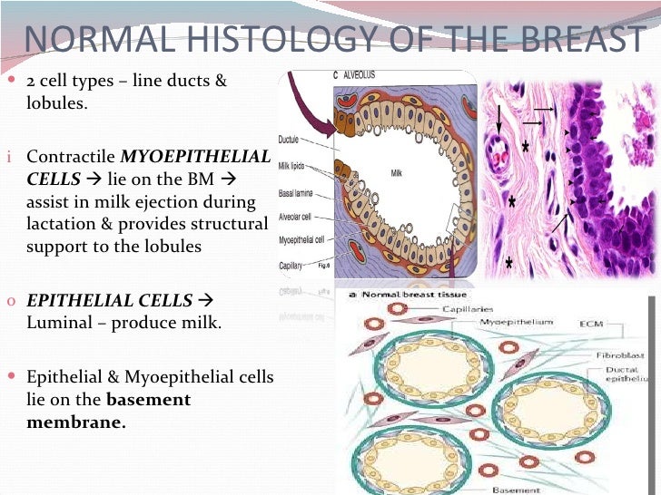Histological types of basal cell carcinoma