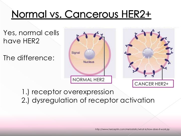 T cells that recognize HER2 teceptor may prevent HER2+ breast cancer recurrence