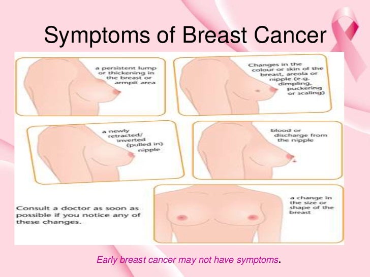 Is Milk In Breast Part Of Early Pregnancy 75