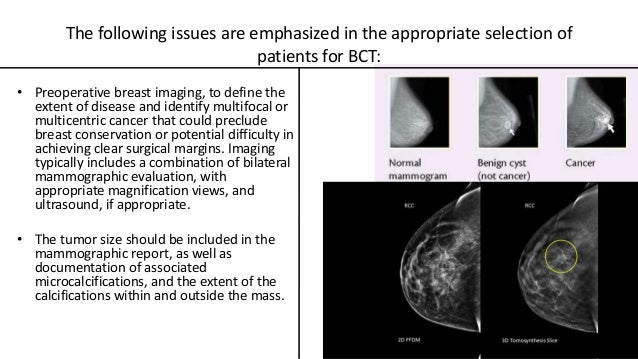 is recurrent lung most cancers stage 4