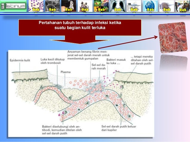 Bab
1
Bab
2
Bab
3
Bab
4
Bab
5
Bab
6
Bab
7
Bab
8
Bab
9
Bab
10
Pertahanan tubuh terhadap infeksi ketika ...