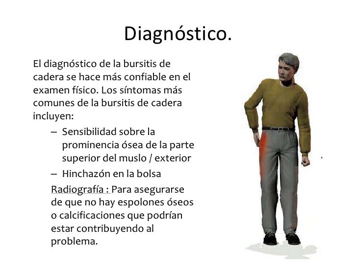 Bursitis trocantereana Bursitis trocantereana