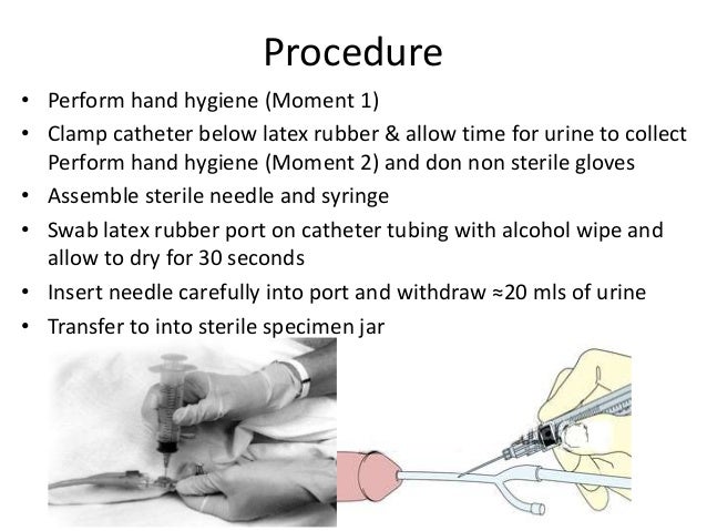 vap catheter cauti cabsi sterile
