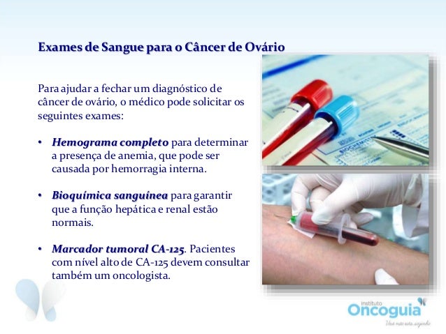 Exame de sangue ca 125 para que serve