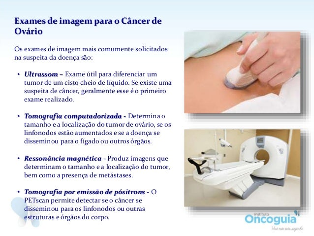 Exame de sangue ca 125 para que serve