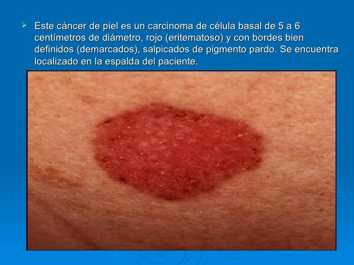 Las manchas de pigmento en el cuerpo del recién nacido
