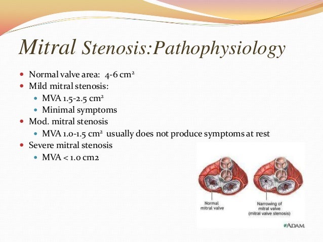 Stroke control ppt hemorrhagic stroke symptoms and symptoms