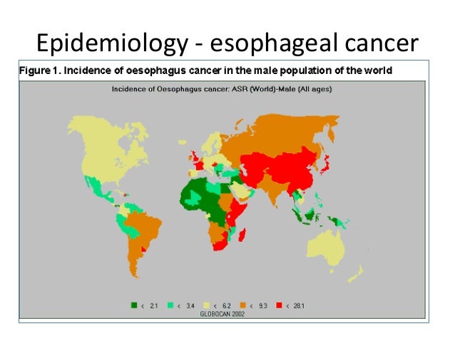 Living With Esophageal Cancer Living With Esophageal Cancer