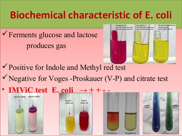E. Coli - Out With The Old E. Coli - Out With The Old