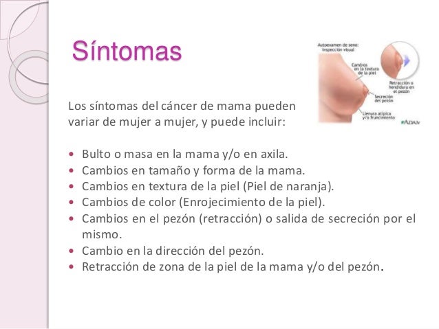 Cáncer De Mama