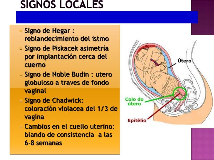 Signo De Jacquemier Chadwick Johnson