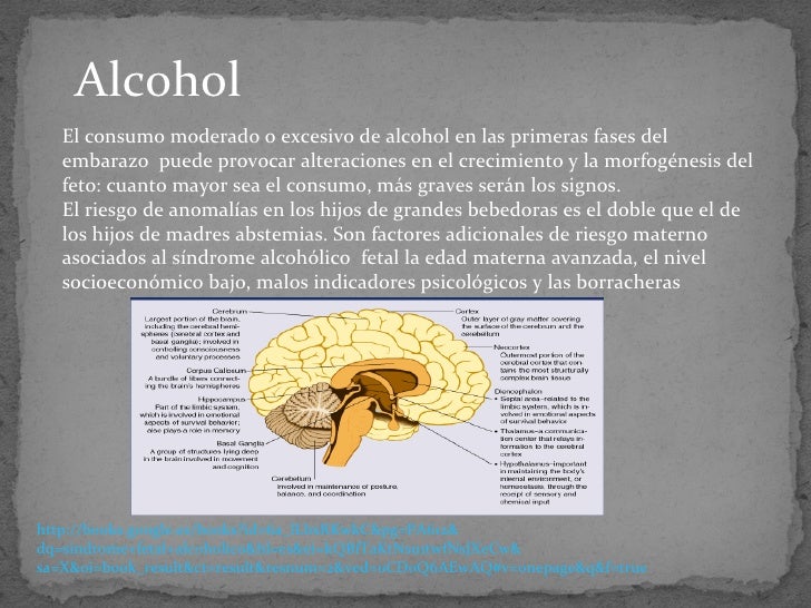 Progredientnost las corrientes del alcoholismo