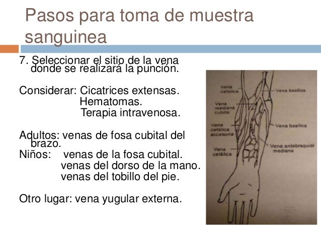 Las venas en los pies se hacían violeta