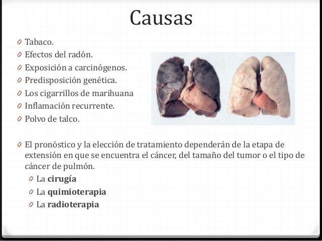 Las compresas del dolor y la espalda