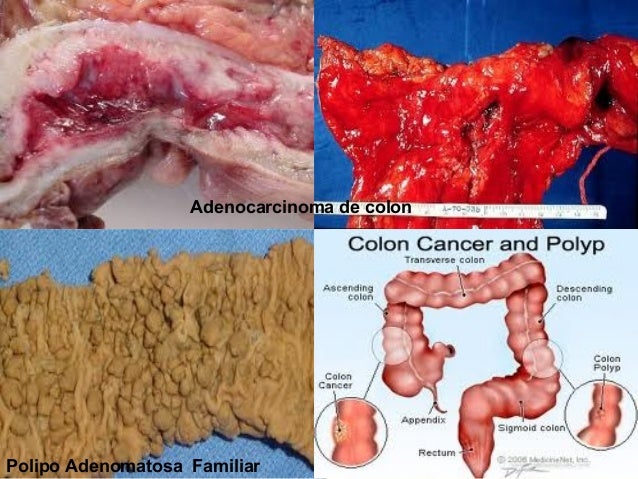 Jugo para limpiar el colon y bajar de peso en 7 dГas papel secante jugo para limpiar el colon y bajar de peso en 7 dГas