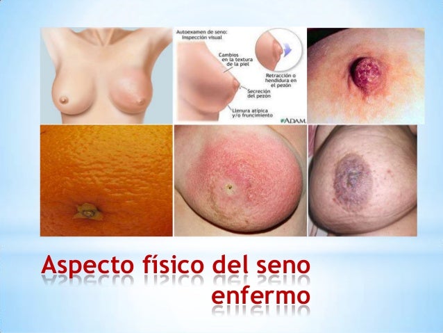 Bolyat las orejas limfouzly sobre el cuello
