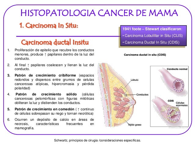 Cancer Maligno