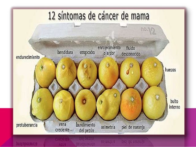 Artigo cancer de mama