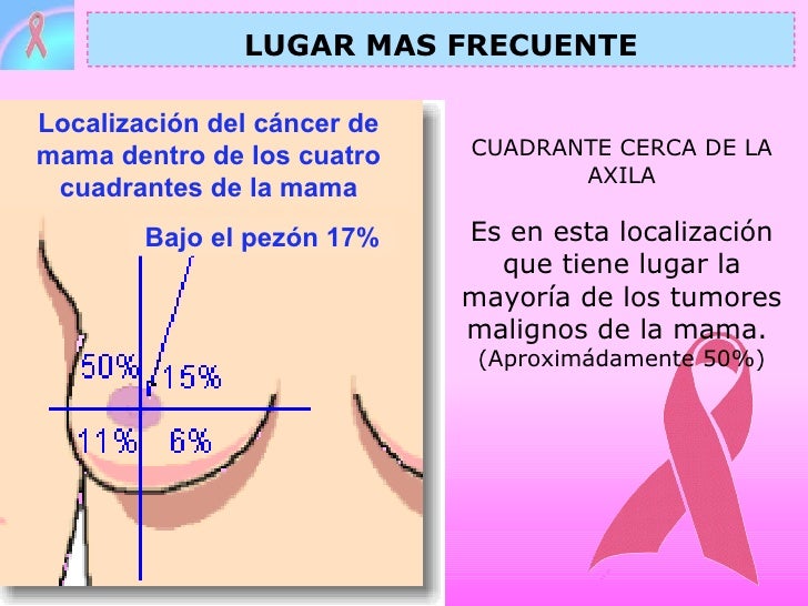 Artigo cancer de mama