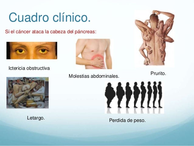 que alimentos dejar de comer para bajar grasa abdominal Algunos que alimentos dejar de comer para bajar grasa abdominal comenzar con series
