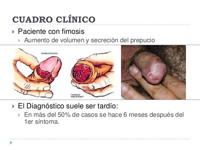 Porno chupaba el relato como el miembro al pequeño muchacho