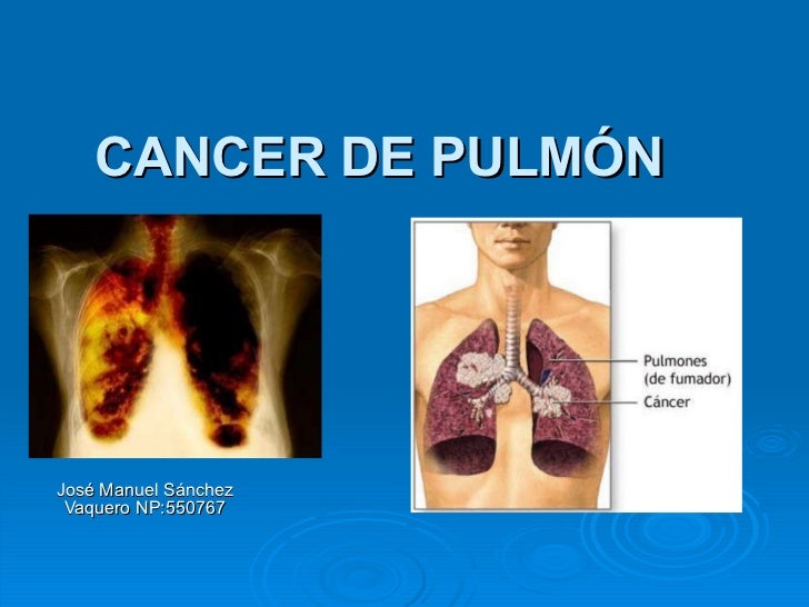 Las como eliminar grasa pectoral rapido posicin como eliminar grasa pectoral rapido